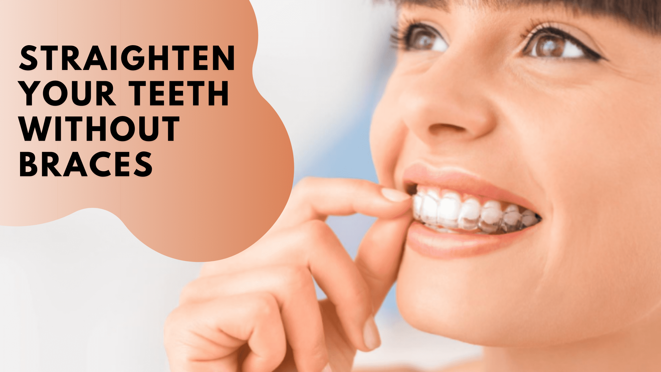 Straighten Your Teeth without Braces