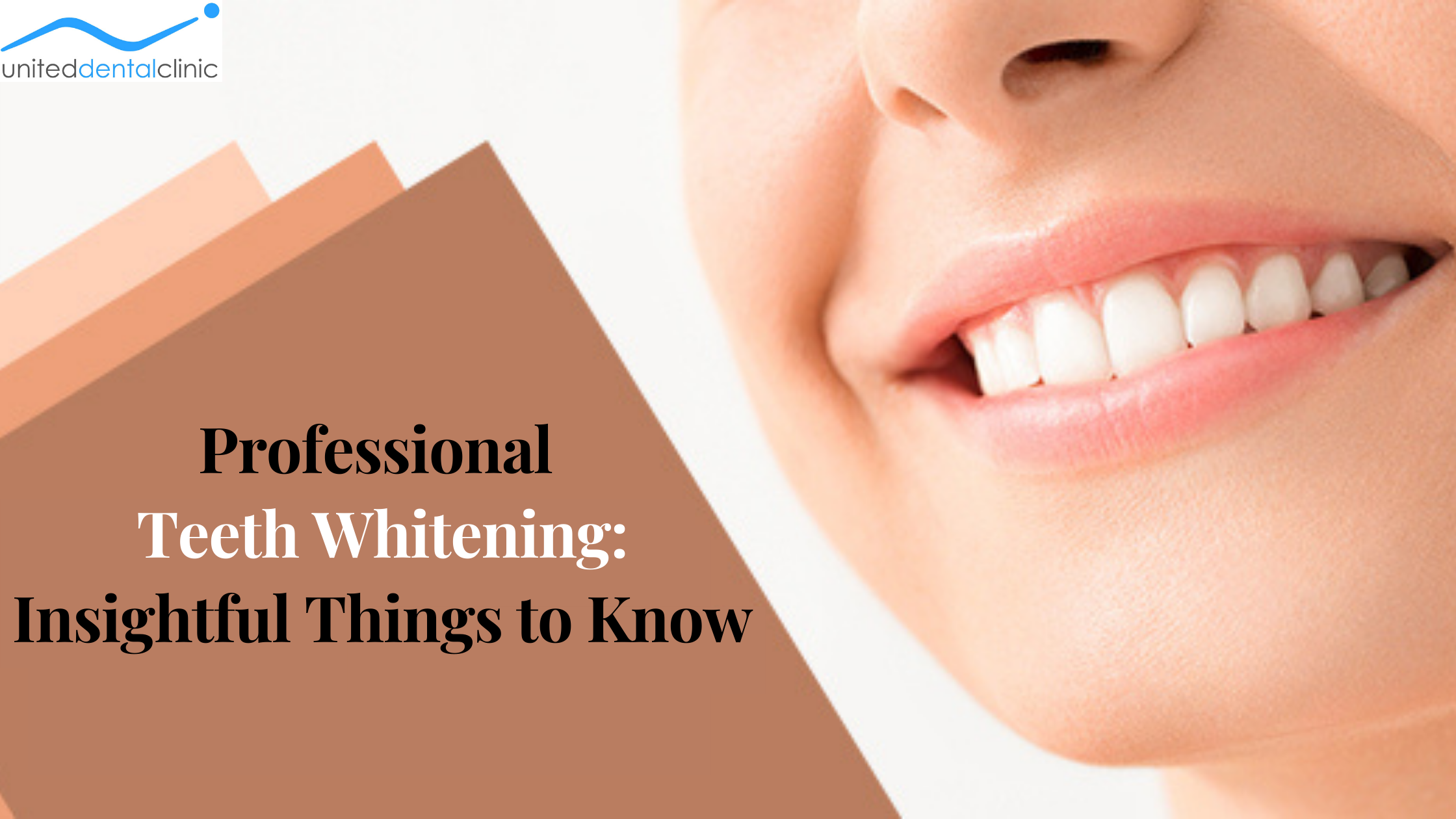 What to Know About Professional Teeth Whitening in Northern Beaches?