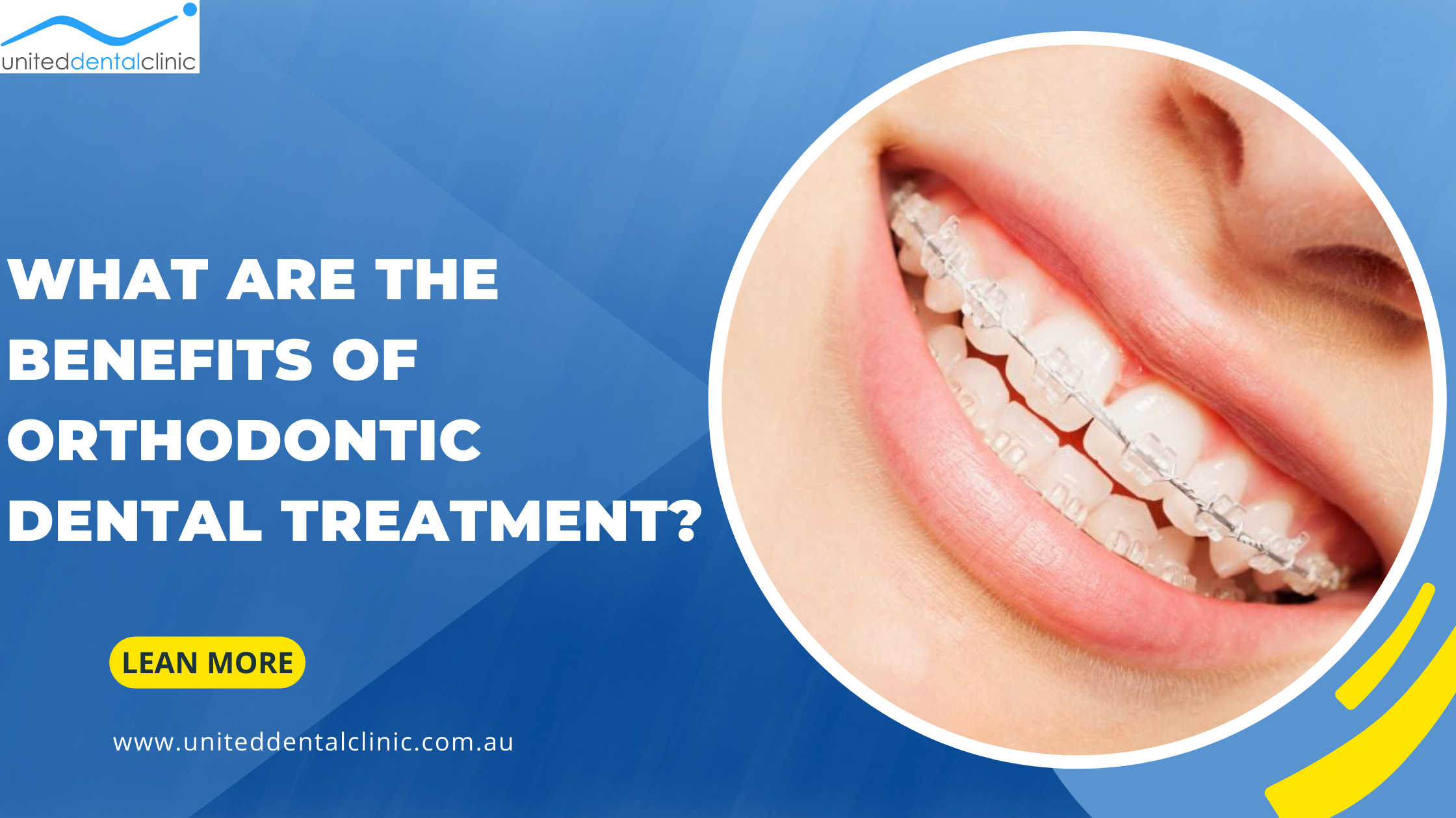 What Are The Benefits Of Orthodontic Dental Treatment?