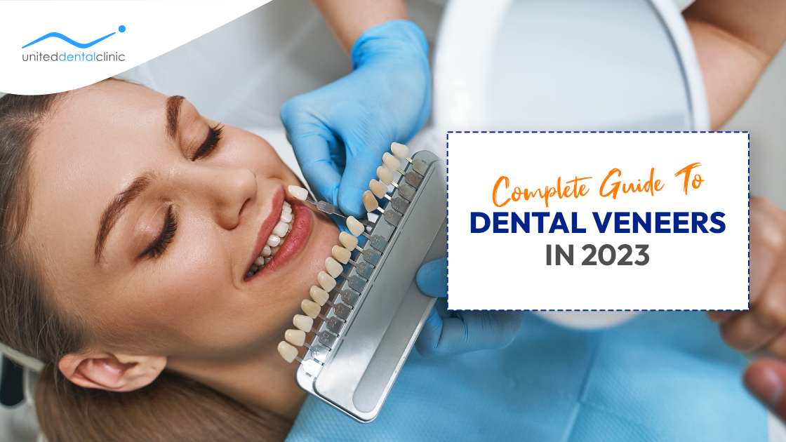 Complete Guide to Dental Veneers in 2023