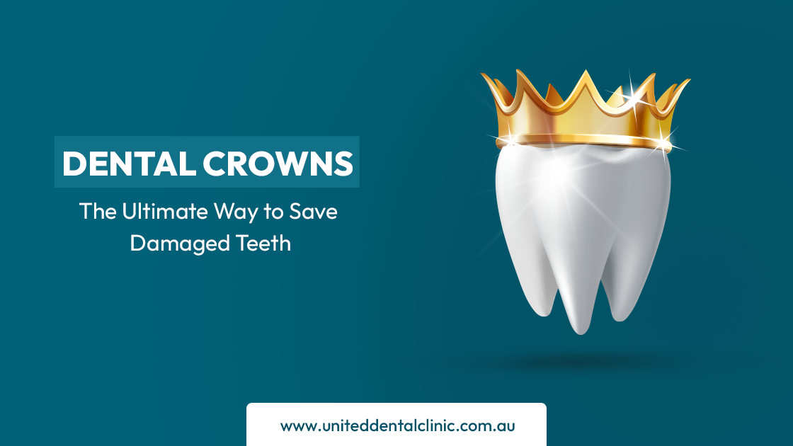 Dental Crowns: The Ultimate Way to Save Damaged Teeth