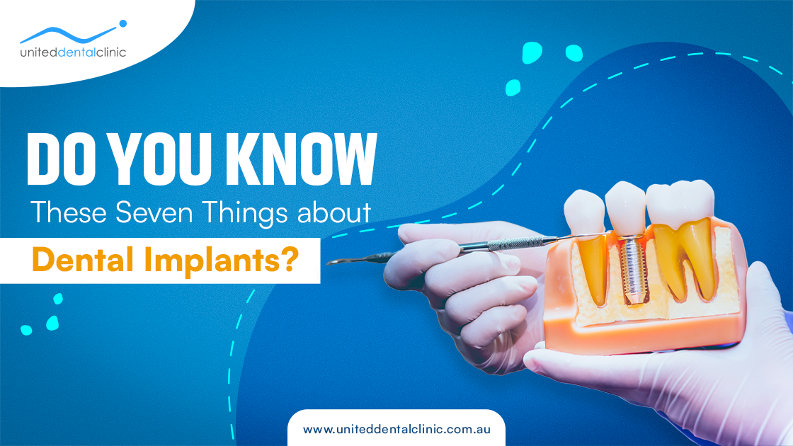 Do You Know These Seven Things about Dental Implants?