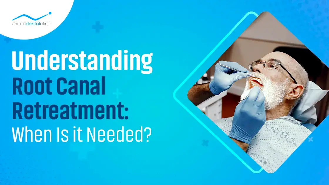 Understanding Root Canal Retreatment: When Is it Needed?