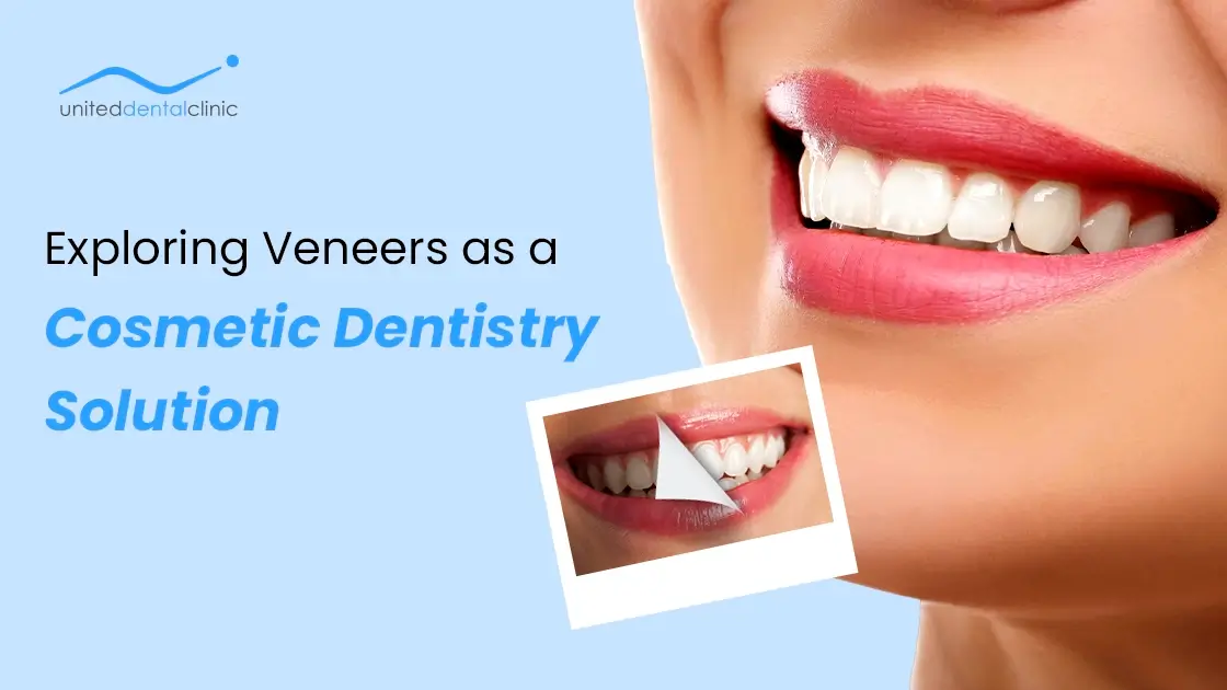 Exploring Veneers as a Cosmetic Dentistry Solution