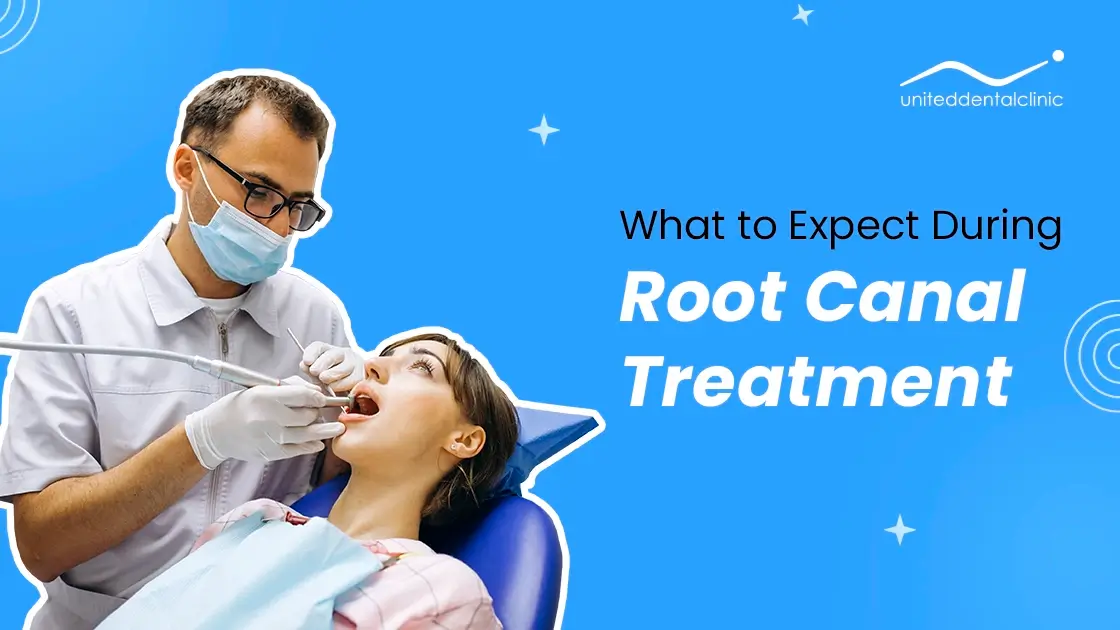 What to Expect During Root Canal Treatment