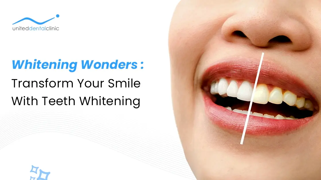 Whitening Wonders: Transform Your Smile with Teeth Whitening
