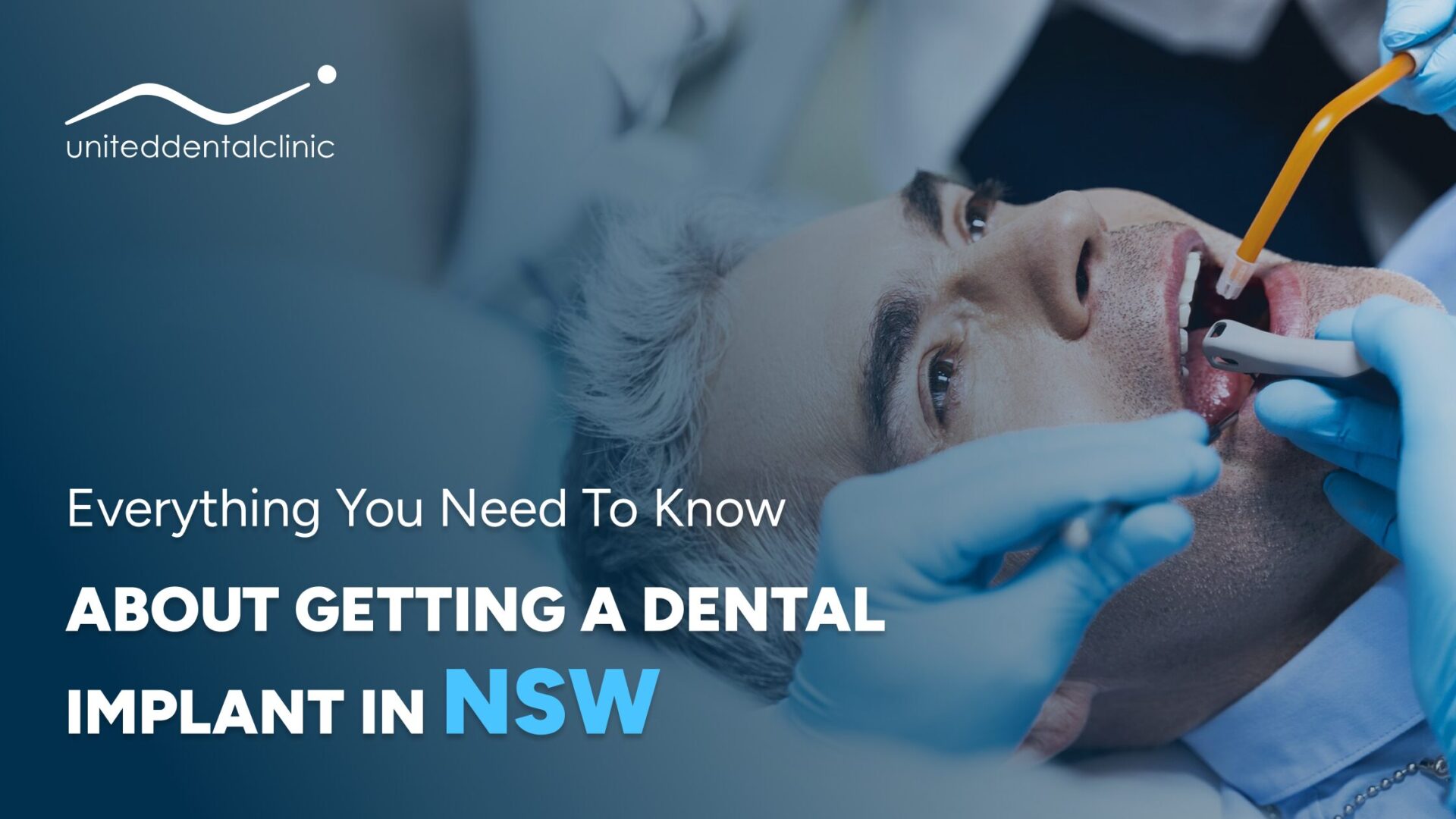 Everything You Need to Know About Getting a Dental Implant in NSW