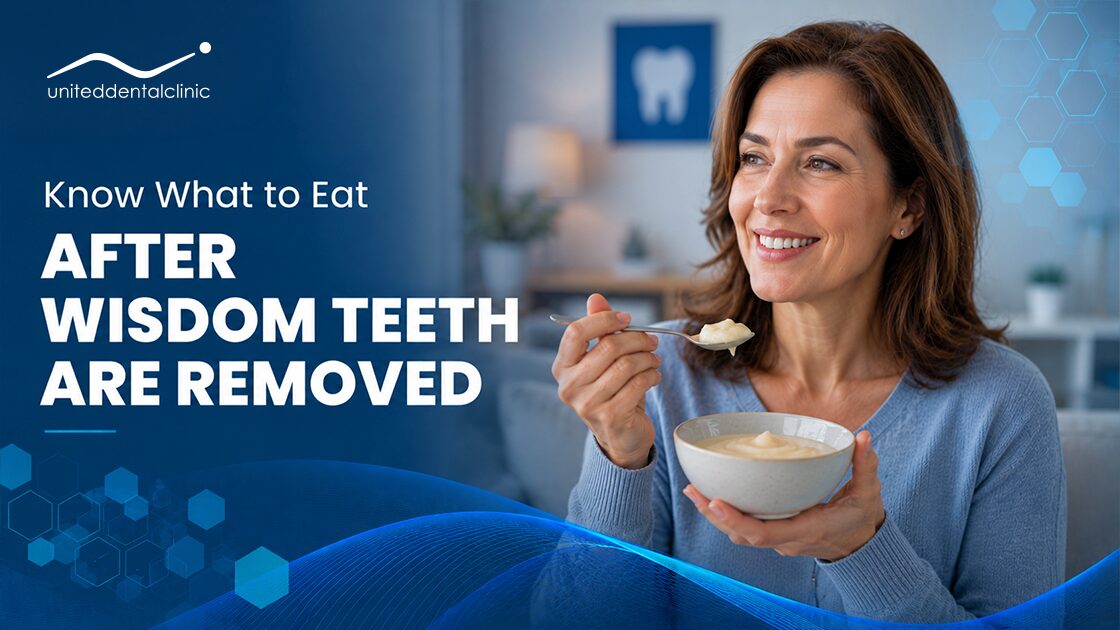 Know What to Eat After Wisdom Teeth Are Removed